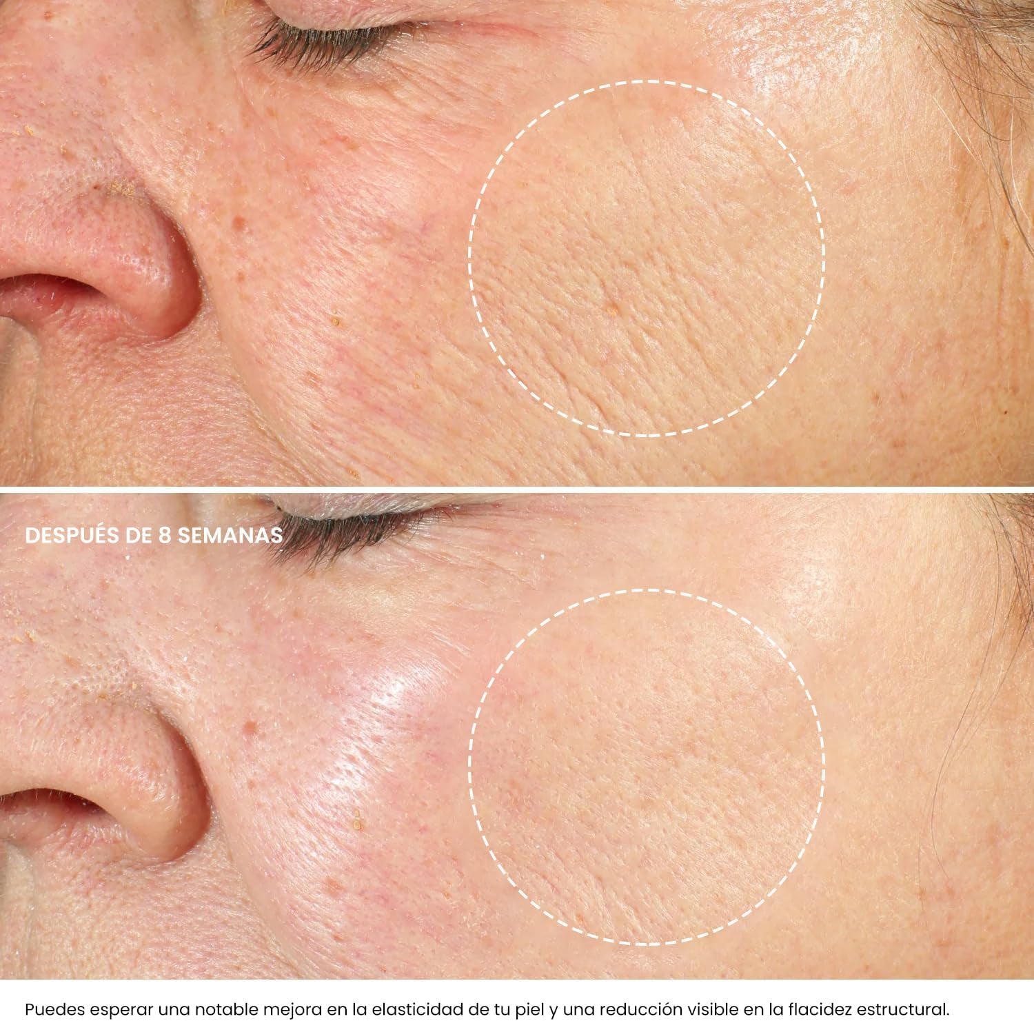 Crema Hidratante Facial Mujer Y Hombres Con Retinol, Ácido Hialurónico Y Vitamina E– Crema Antiarrugas Mujer Para Reducir Arrugas, Líneas Finas Y Manchas Oscuras – Antiedad Facial Crema De Noche -50Ml