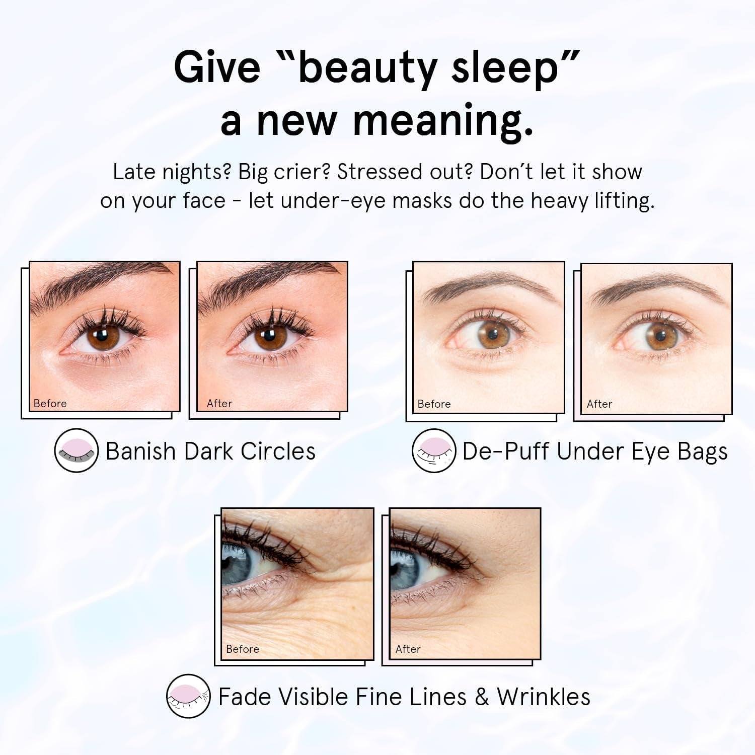 Grace & Stella Parches Ojos, Ojeras Y Bolsas – Parches Hidrogel Para Ojos Con Retinol Y Ácido Hialurónico – 24 Pares, Color Morado, Vegano, No Testado En Animales
